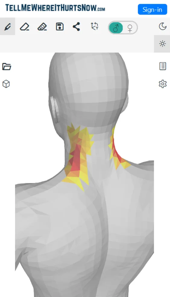 Neck Pain